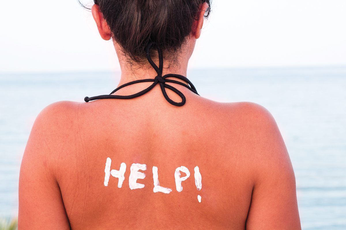 5 loại mặt nạ cấp cứu làn da bị cháy nắng khi đi biển 1