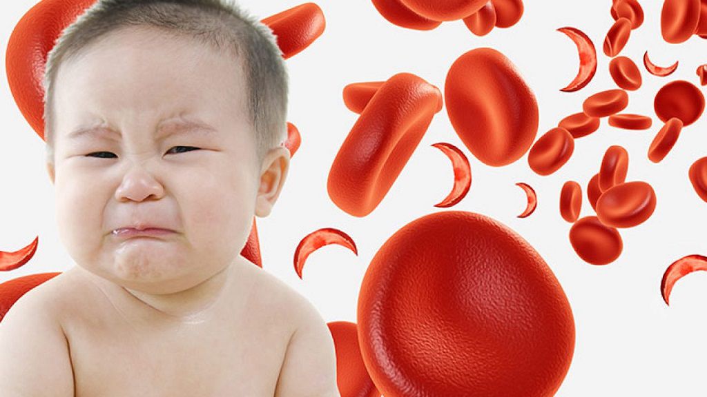 Bệnh nhiễm trùng máu ở trẻ sơ sinh và những điều mẹ cần biết