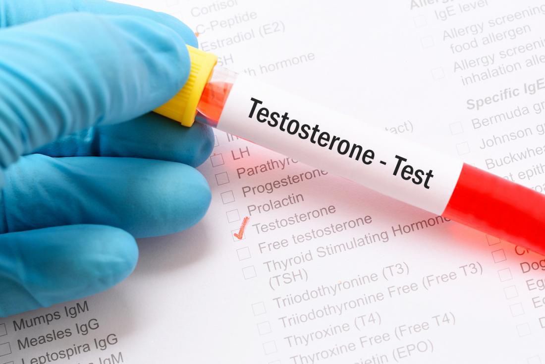 Có những cách gì để kiểm tra nồng độ Testosterone? 1