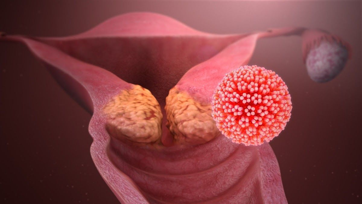 Con đường lây nhiễm HPV và cách đề phòng 1