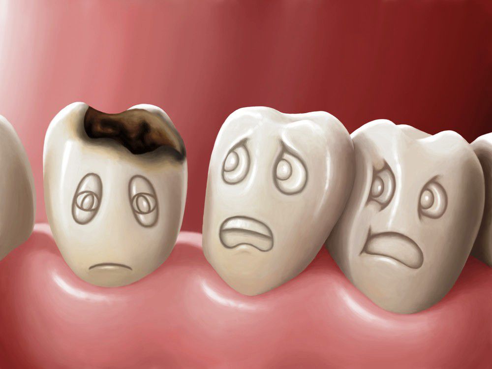 Giải pháp hạn chế nguy cơ sâu răng và các bệnh đường miệng ở trẻ 1