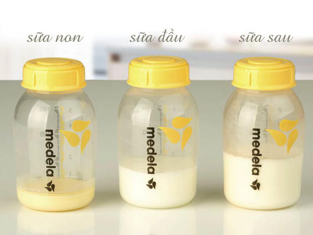 Sữa mẹ màu vàng có tốt cho trẻ hay không 2