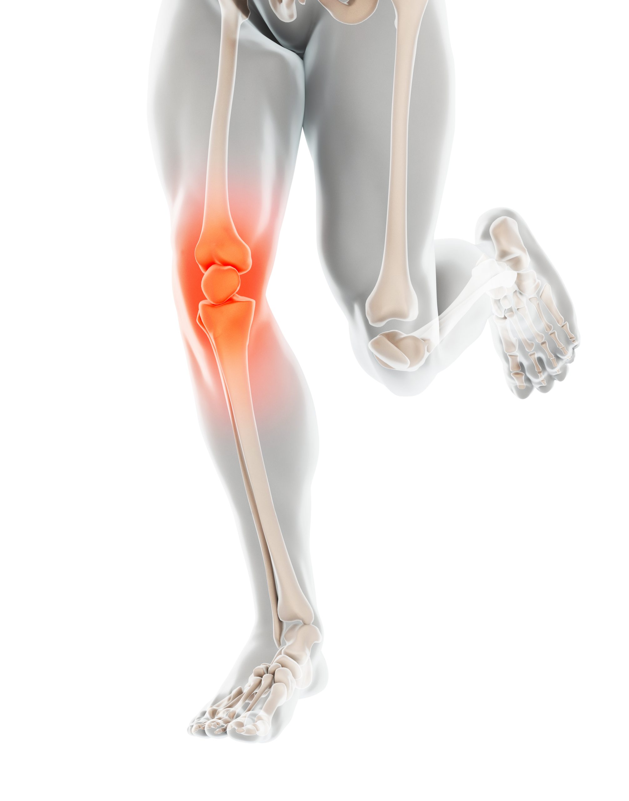 Knee,painful, ,skeleton,x Ray,,3d,illustration,medical,concept.